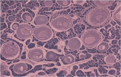 intersex gonads fish estrogen rivers